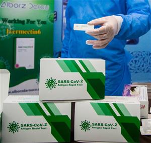 آغاز به کار خط تولید کیت تشخیص فوری کرونا در ایران